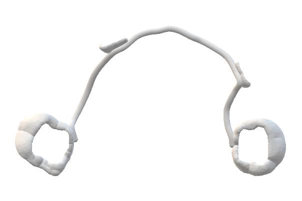 Arc lingual / Arc transpalatin